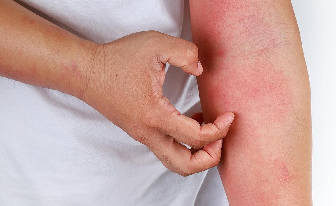 mogelijke complicaties bij het gebruik van frisdrank